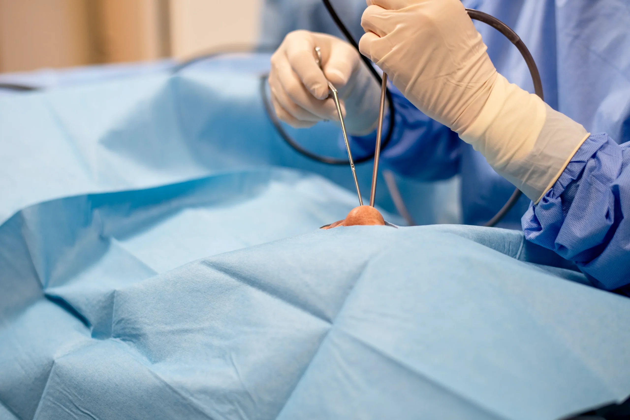 鼻中隔弯曲症の手術をうけるのに適した時期　～鼻の中の壁はいつ曲がっていくのか～